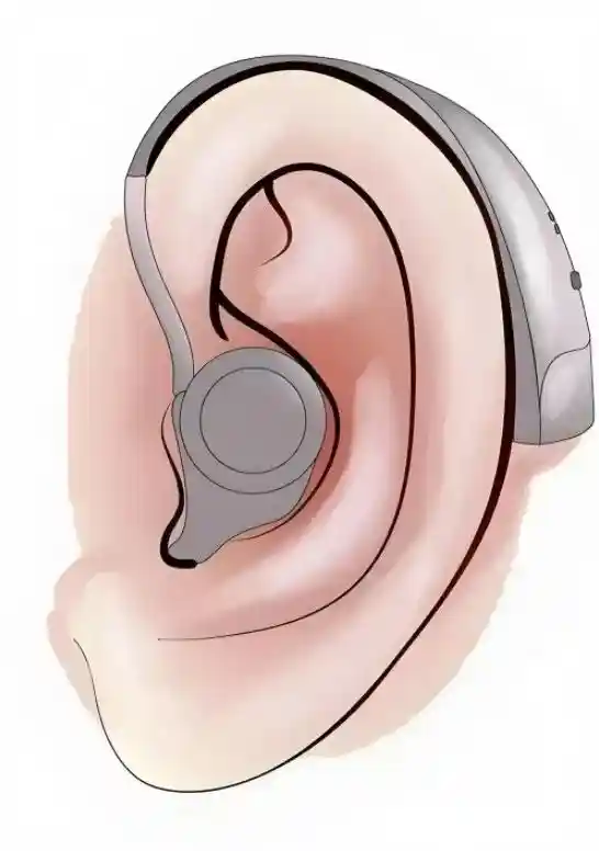 Principle of hearing aid