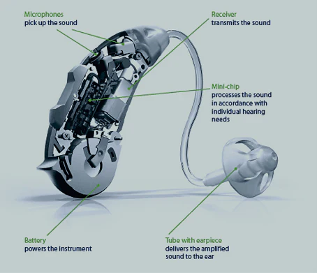 The structure of hearing AIDS
