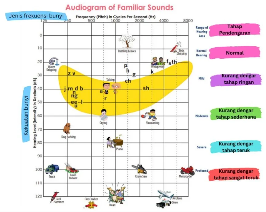 Hearing aid audiogram
