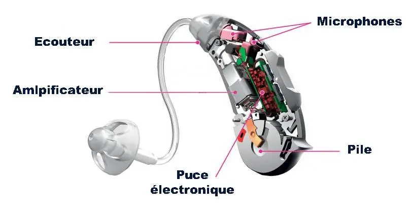 The structure diagram of the hearing aid