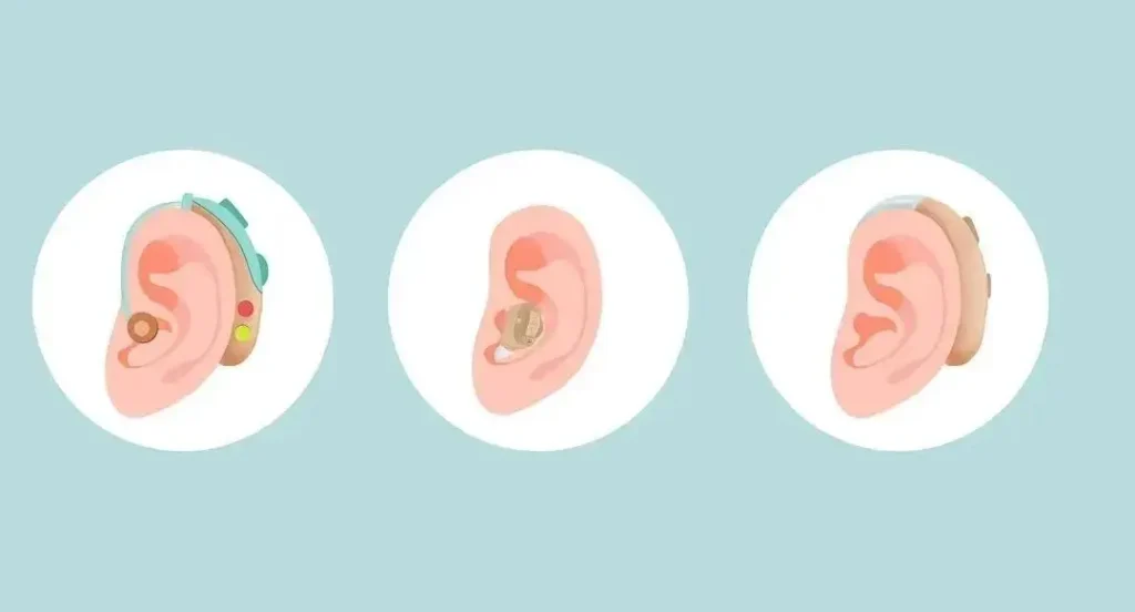 Different forms of hearing AIDS