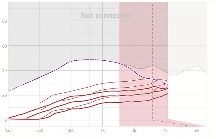 High-frequency remodeling of hearing AIDS