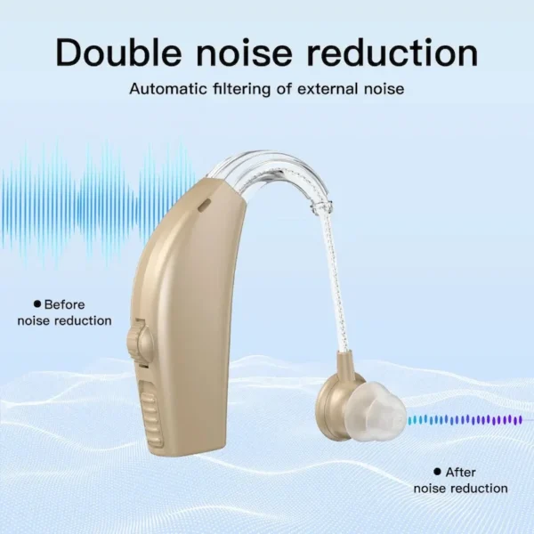 GM-301 hearing aid noise reduction