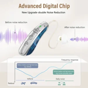 ZF-M908 smart chip for hearing AIDS (1)