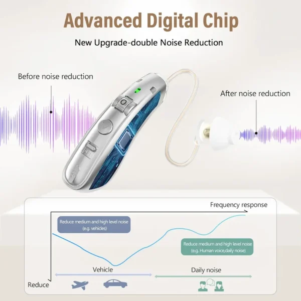 ZF-M908 smart chip for hearing AIDS (1)